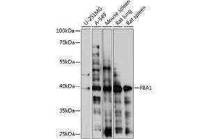 Western blot analysis of extracts of various cell lines, using F8 antibody (4806) at 1:1000 dilution. (Coagulation Factor VIII-Associated 1 (F8A1) (AA 150-250) 抗体)