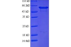 SDS-PAGE (SDS) image for DEAD (Asp-Glu-Ala-Asp) Box Polypeptide 58 (DDX58) (AA 1-430), (ATP-binding domain) protein (His tag) (ABIN5709395)