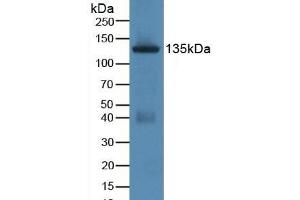 Detection of JAG1 in Rat Uterus Tissue using Polyclonal Antibody to Jagged 1 (JAG1) (JAG1 抗体  (AA 470-834))