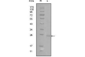 Western blot analysis using GATA3 mouse mAb against truncated GATA3-His recombinant protein (1). (GATA3 抗体)