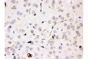 Ceruloplasmin was detected in paraffin-embedded sections of rat brain tissues using rabbit anti- Ceruloplasmin Antigen Affinity purified polyclonal antibody at 1 μg/mL. (Ceruloplasmin 抗体  (AA 20-258))