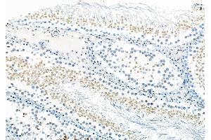 ABIN6261078 and ABIN6278562 at 1/100 staining Rat testis tissue by IHC-P.