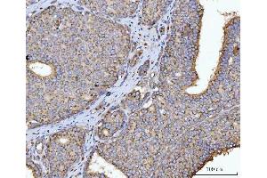 IHC analysis of HMGCR using anti-HMGCR antibody (ABIN7600989).