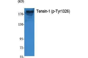 Western Blotting (WB) image for anti-Tensin 1 (TNS1) (pTyr1326) antibody (ABIN3173571) (Tensin 1 抗体  (pTyr1326))
