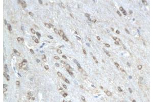 Formalin-fixed and paraffin embedded rat colitis labeled with Anti-phospho-MAP4(Ser941) Polyclonal Antibody, Unconjugated  followed by conjugation to the secondary antibody and DAB staining (MAP4 抗体  (pSer941))