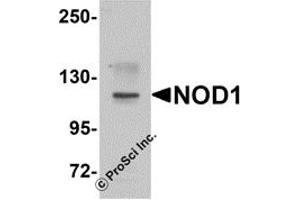 Western Blotting (WB) image for anti-Nucleotide-Binding Oligomerization Domain Containing 1 (NOD1) (C-Term) antibody (ABIN1030546) (NOD1 抗体  (C-Term))