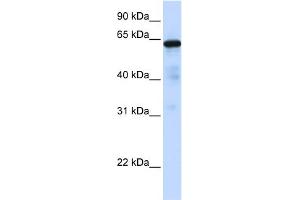 WB Suggested Anti-FOXN4 Antibody Titration:  0.
