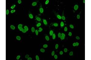 Immunofluorescence staining of Hela cells with ABIN7139181 at 1:10, counter-stained with DAPI. (H2AFZ 抗体  (acLys4))