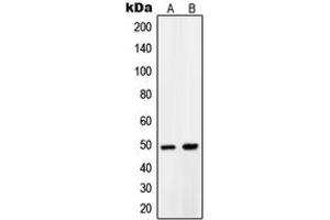 Western blot analysis of PDK1 expression in LNCaP (A), A431 (B) whole cell lysates. (PDPK1 抗体  (Center))