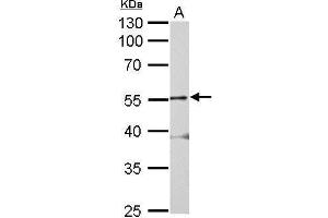 WB Image Glycine Receptor alpha 2 antibody detects GLRA2 protein by Western blot analysis. (GLRa2 抗体)