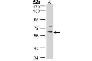 WB Image Sample(30 ug whole cell lysate) A:Hep G2 , 10% SDS PAGE antibody diluted at 1:2000 (STK33 抗体)