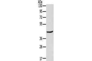 Gel: 8 % SDS-PAGE,Lysate: 40 μg,Primary antibody: ABIN7191352(MAGEB3 Antibody) at dilution 1/200 dilution,Secondary antibody: Goat anti rabbit IgG at 1/8000 dilution,Exposure time: 10 seconds (MAGEB3 抗体)