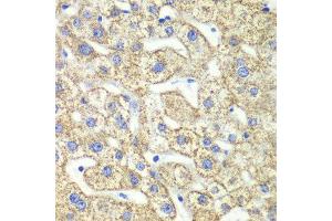 Immunohistochemistry of paraffin-embedded human liver injury using GLUD2 antibody at dilution of 1:100 (x40 lens). (GLUD2 抗体)
