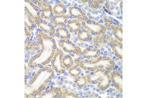 Immunohistochemistry of paraffin-embedded rat kidney using DAP antibody (ABIN5973626) at dilution of 1/200 (40x lens). (DAP 抗体)