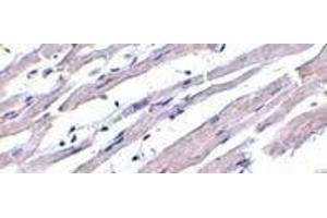 Immunohistochemistry of Apaf1 in human heart tissue with Apaf1 (NT) antibody at 1μg/ml. (APAF1 抗体  (N-Term))