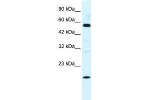 WB Suggested Anti-ZNF436 Antibody Titration:  1. (ZNF436 抗体  (N-Term))