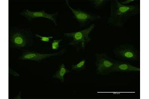 Immunofluorescence (IF) image for anti-Paired-Like Homeodomain 1 (PITX1) (AA 1-314) antibody (ABIN518913)