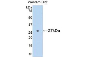 Detection of Recombinant GSTa3, Rat using Polyclonal Antibody to Glutathione S Transferase Alpha 3 (GSTa3) (GSTA3 抗体  (AA 1-221))