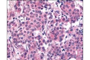 Immunohistochemistry (IHC) image for anti-Polo-Like Kinase 1 (PLK1) (pThr210) antibody (ABIN129581)