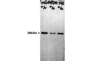 blots of crude extract of peripheral nerve of various knock out mice strains blotted with ABIN1580424 for use as a western blotting control. (GAPDH 抗体)
