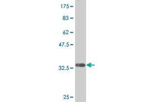 Western Blot detection against Immunogen (34. (DLX1 抗体  (AA 181-254))