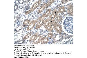 Immunohistochemistry (IHC) image for anti-Cadherin 8 (CDH8) (Middle Region) antibody (ABIN2782142) (Cadherin 8 抗体  (Middle Region))