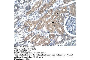 Immunohistochemistry (IHC) image for anti-Cadherin 8 (CDH8) (Middle Region) antibody (ABIN2782142) (Cadherin 8 抗体  (Middle Region))