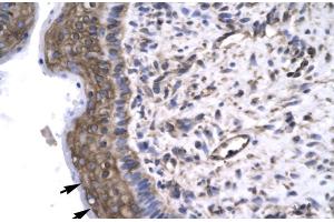 Immunohistochemistry (IHC) image for anti-General Transcription Factor IIF, Polypeptide 2, 30kDa (GTF2F2) (Middle Region) antibody (ABIN2777297)