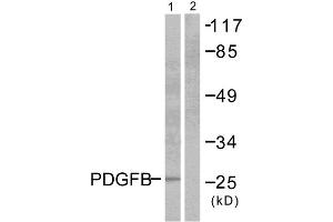 Western blot analysis of extracts from NIH/3T3 cells, using PDGFB antibody (ABIN5976488). (PDGFB 抗体  (Internal Region))