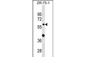 GDPD2 Antibody (Center) (ABIN1538279 and ABIN2849892) western blot analysis in ZR-75-1 cell line lysates (35 μg/lane). (GDPD2 抗体  (AA 305-334))