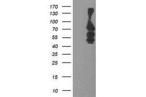 Western Blotting (WB) image for anti-Katanin P80 (WD Repeat Containing) Subunit B 1 (KATNB1) antibody (ABIN1498989) (KATNB1 抗体)