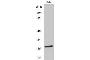 Western Blotting (WB) image for anti-B-Cell CLL/lymphoma 2 (BCL2) (pSer70) antibody (ABIN3179397) (Bcl-2 抗体  (pSer70))