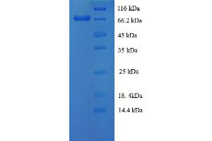 SDS-PAGE (SDS) image for Selenoprotein P (SEPP1) (AA 20-402) protein (GST tag) (ABIN5710332)