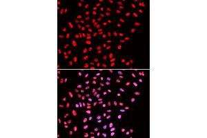 Immunofluorescence analysis of U2OS cells using B/B/SM antibody . (SMARCE1 抗体  (AA 1-411))