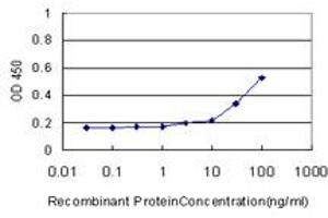 Detection limit for recombinant GST tagged SOD3 is approximately 10ng/ml as a capture antibody. (SOD3 抗体  (AA 26-125))