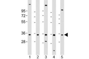 Western blot testing of human 1) HL-60, 2) K562, 3) MCF-7, 4) MOLT-4 and 5) SH-SY5Y cell lysate with PIGC antibody at 1:2000. (PIGC 抗体  (AA 81-112))