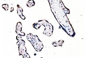 IHC analysis of splicing factor 1 using anti-splicing factor 1 antibody (ABIN7600194).