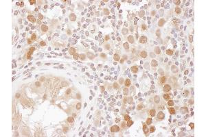 Immunohistochemistry (IHC) image for anti-CSE1 Chromosome Segregation 1-Like (CSE1L) (AA 1-50) antibody (ABIN7453909) (Exportin 2 抗体  (AA 1-50))