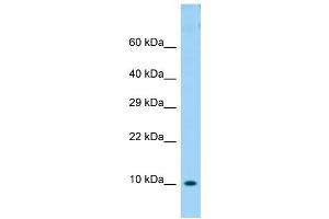 Host: Rabbit Target Name: COX6B1 Sample Type: OVCAR-3 Whole Cell lysates Antibody Dilution: 1. (COX6B1 抗体  (N-Term))