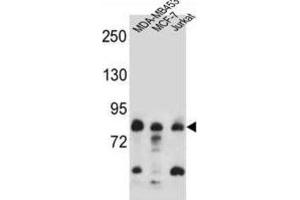 Western Blotting (WB) image for anti-AFG3-Like Protein 2 (AFG3L2) antibody (ABIN2997215) (AFG3L2 抗体)