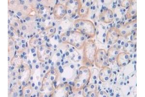 Immunohistochemistry (IHC) image for anti-Brevican (BCAN) (AA 23-353) antibody (ABIN7443593)