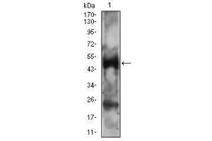Western blot analysis using PTPN1 mouse mAb against A431 cell lysate. (PTPN1 抗体  (AA 40-246))