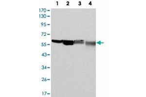 Western blot analysis using G6PD monoclonal antibody, clone 5E12  against HeLa (1) , MCF-7 (2) , Jurkat (3) and K-562 (4) cell lysate. (Glucose-6-Phosphate Dehydrogenase 抗体)