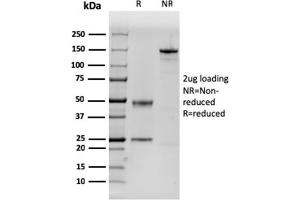SDS-PAGE Analysis Purified Dystrophin Monospecific Mouse Monoclonal Antibody (DMD/3243). (Dystrophin 抗体  (AA 114-263))
