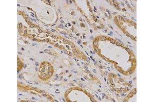 Immunohistochemistry of paraffin-embedded Human kidney using ARHGAP25 Polyclonal Antibody at dilution of 1:200 (40x lens). (ARHGAP25 抗体)