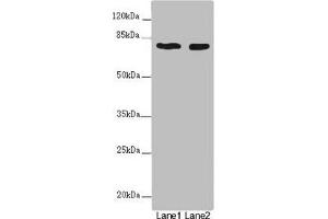 Western blot All lanes: UVRAG antibody at 2 μg/mL Lane 1: SH-SY5Y whole cell lysate Lane 2: 293T whole cell lysate Secondary Goat polyclonal to rabbit IgG at 1/10000 dilution Predicted band size: 79, 36 kDa Observed band size: 79 kDa (UVRAG 抗体  (AA 375-425))