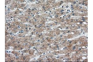 Immunohistochemical staining of paraffin-embedded Human liver tissue using anti-KHK mouse monoclonal antibody. (Ketohexokinase 抗体)