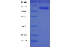 SDS-PAGE (SDS) image for Adenosylhomocysteinase (AHCY) (AA 2-432) protein (His-SUMO Tag) (ABIN5709017)