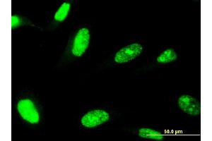 Immunofluorescence of monoclonal antibody to ZNF81 on HeLa cell. (ZNF81 抗体  (AA 1-122))