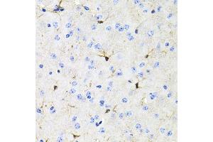 Immunohistochemistry of paraffin-embedded mouse brain using ACVR2A antibody (ABIN5971030) at dilution of 1/100 (40x lens). (ACVR2A 抗体)